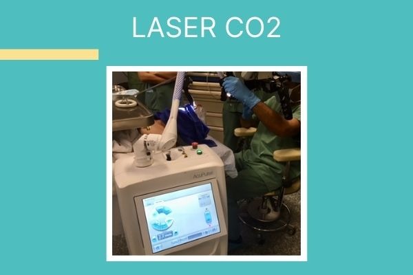 Laser CO2