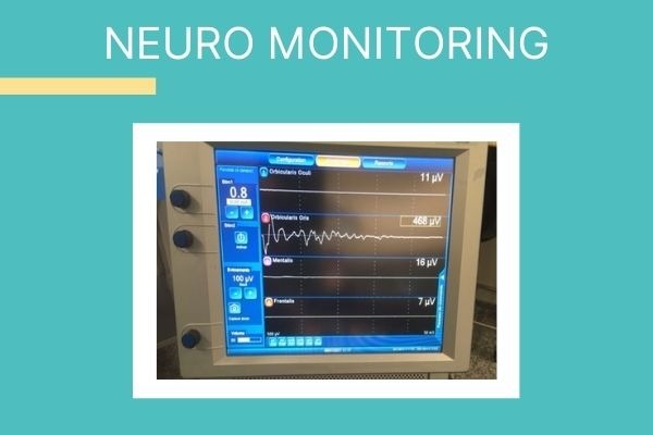 neuro monitoring